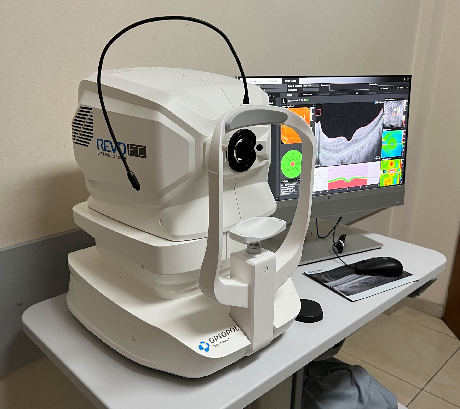 Revo FC retina diagnostic machine — OCT imaging at Vishwakarma Eye Clinic